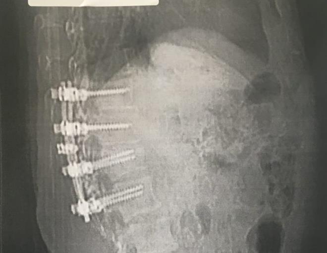 Total of eight screws hold me together - photo © Glen and Mary Wilson