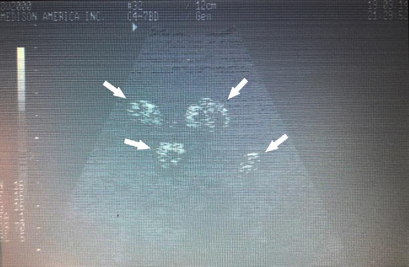 Ultrasound of four ovarian follicles filled with yolk from a gravid adult female green sea turtle (OA48) observed on Oahu's North Shore. - photo © NOAA Fisheries / Camryn Allen